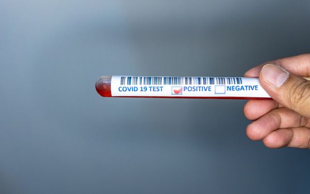 Cel mai exact test de până acum pentru depistarea COVID-19 și a anticorpilor, aprobat în SUA