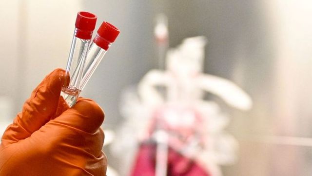 Guvernul a decis: Testele PCR la Covid-19 vor costa 300 de lei în instituțiile medicale publice