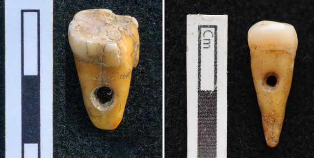 Ékszerként használták a 8500 éves fogakat