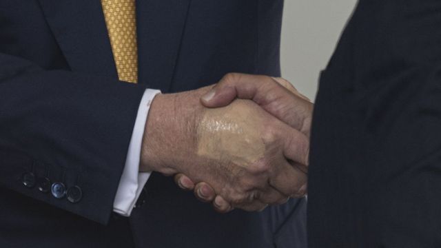 Krónikus betegséget diagnosztizáltak Donald Trumpnál, megszólalt a Fehér Ház