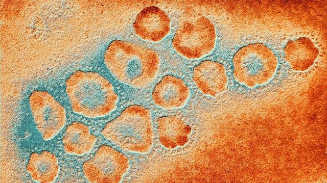 Nebezpečný koronavir je v Evropě, Francie hlásí dva nakažené