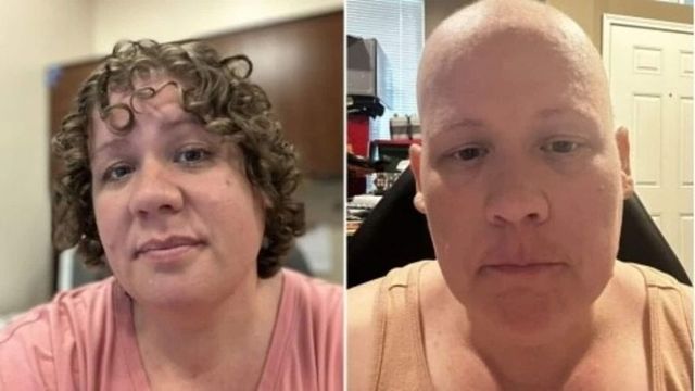 Texas woman who underwent 15 months of aggressive chemotherapy told she never had cancer