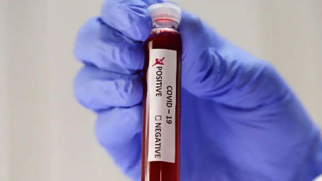 Patanjali takes u-turn on coronavirus drugs claims, says no such medicine made
