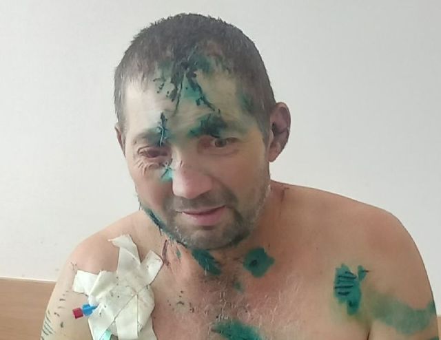 Un bărbat din raionul Căușeni a fost desfigurat de o haită de cîini