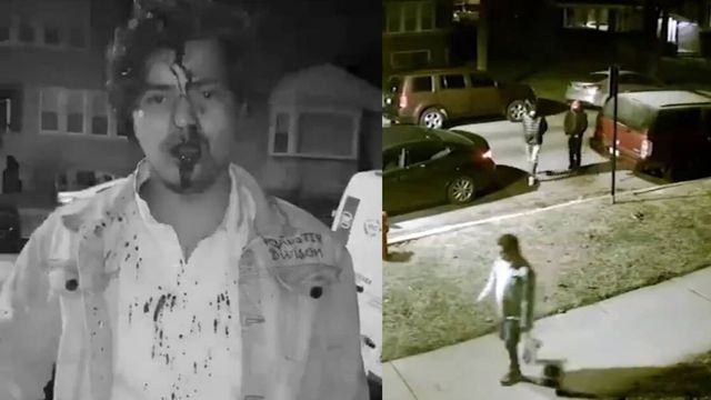 Indian student chased, brutally attacked by 4 men in Chicago
