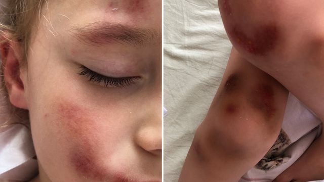 Fetiță de 5 ani, lovită violent de un biciclist în parcul Valea Trandafirilor