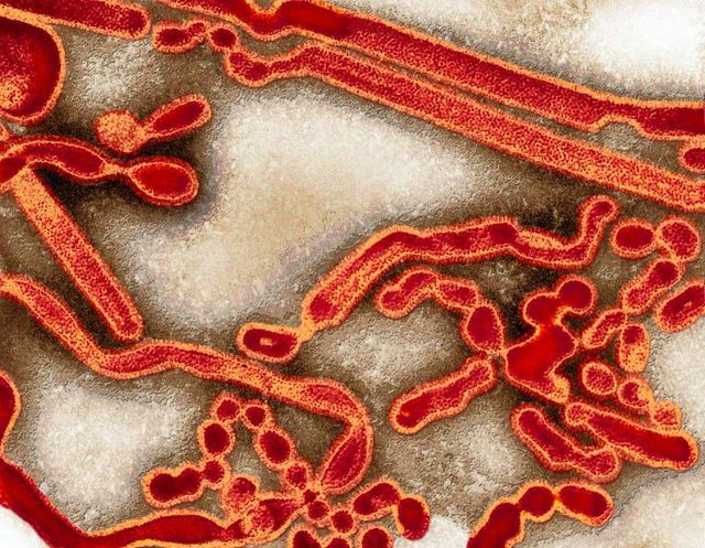 Pacient de 41 de ani, diagnosticat cu gripă, a murit la Sibiu