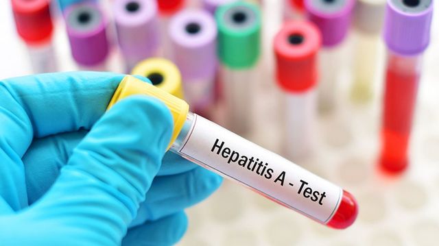 A fost lansată testarea rapidă la hepatitele virale B și C
