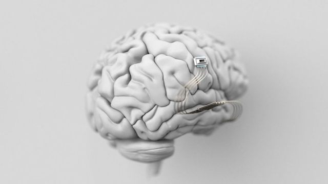 Neuralink a lui Elon Musk a primit aprobarea de a recruta oameni pentru un test de implant cerebral