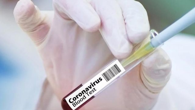 O femeie de 38 de ani cu coronavirus, fără afecțiuni preexistente, a murit la Constanța