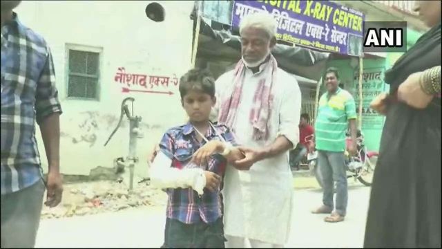 Bihar Boy Gets His Left Hand Fractured, Doctors Cast Plaster On Right