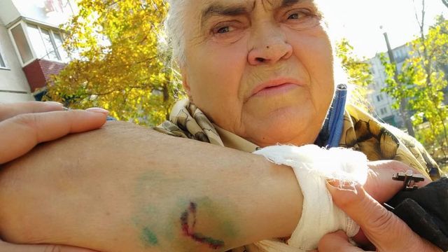 La Bălți, trei maidanezi au atacat o femeie de 78 de ani
