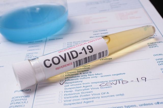 Copil, în vârstă de 12 ani, decedat din cauza coronavirusului în Belgia
