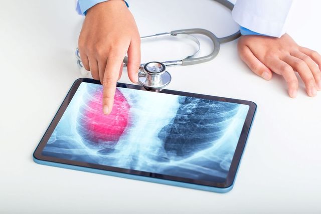 Consultații medicale gratuite în Criuleni, Cantemir și Ungheni