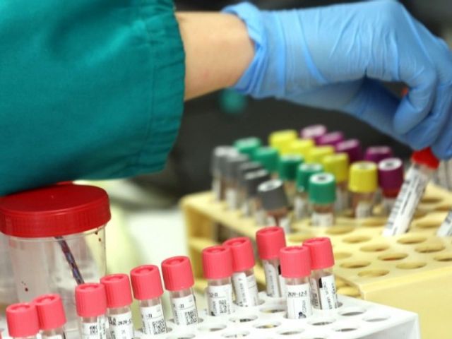 Експериментално лекарство действа срещу коронавирус