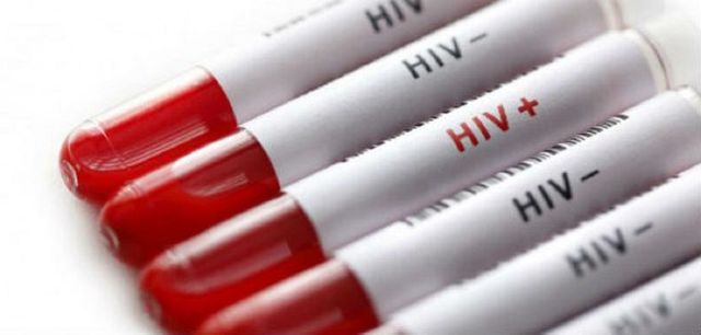 In acest an, in Republica Moldova аu fost confirmate 742 de cazuri noi cu HIV