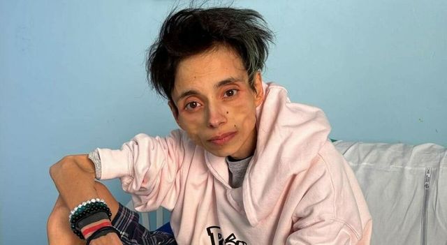 Thiago Elar, morto a 27 anni il tiktoker ricoverato da mesi