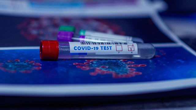 Страны Евросоюза договорились о взаимном признании тестов на коронавирус