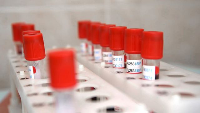 В РФПИ предложили вакцинировать от коронавируса каждого третьего россиянина