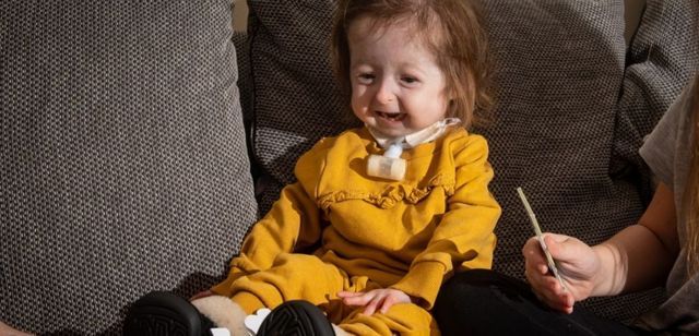 Fețită de doi ani din Marea Britanie, diagnosticată cu boala lui „Benjamin Button“