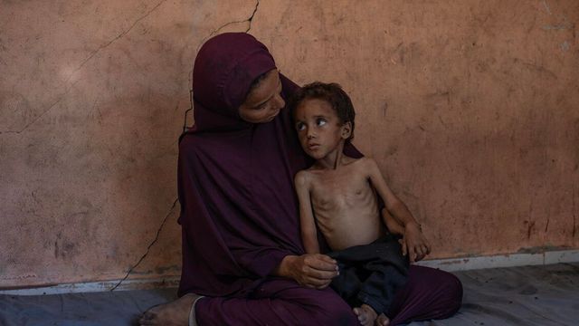 Fonti mediche, 19 palestinesi morti di fame in 24 ore