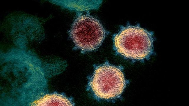 Covid-19: No cause for panic, says health department