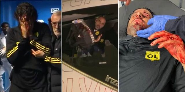 Marsiglia, attacco a pullman Lione: Grosso ferito al volto