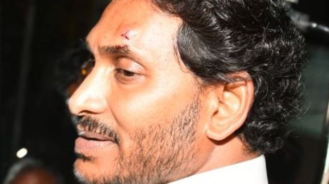 Jagan Reddy injured in stone pelting during bus tour in Vijayawada