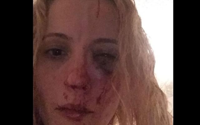 Româncă din Anglia cere ajutor, după ce ar fi fost agresată în fața casei de 10 tineri, publică imagini de coșmar