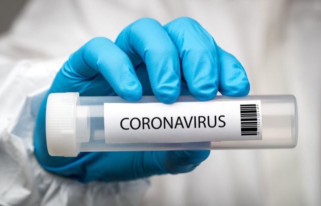 Девять сотрудников МВД заразились коронавирусом