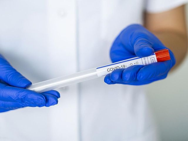 Un alt lot de 100 mii teste pentru depistarea noului tip de coronavirus și 8 ambulanțe vor fi procurate de Ministerul Sănătății