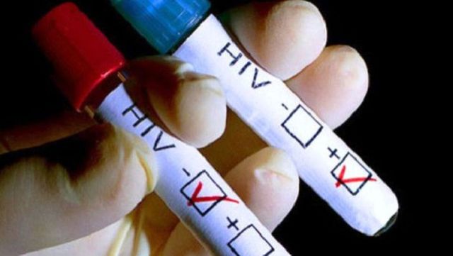 Estimativ 14,5 mii de persoane cu HIV sunt în Republica Moldova