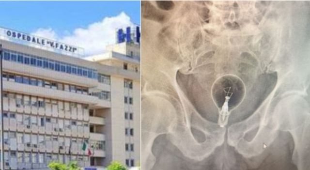 Lecce, anziano ricoverato d’urgenza: trovata una lampadina nel retto