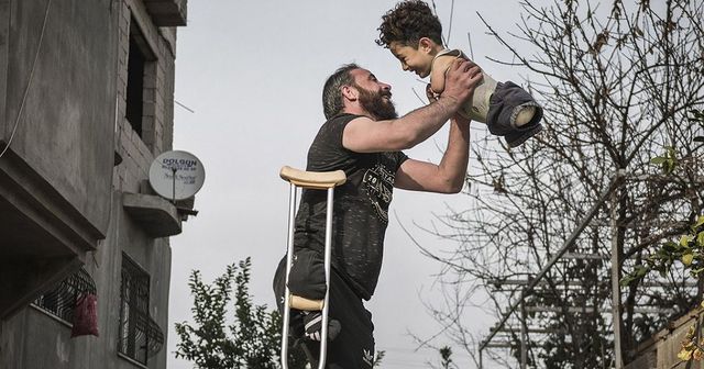 Bimbo e papà senza arti, la foto simbolo del dramma siriano