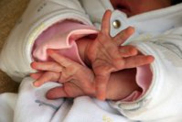 Încă un bebeluș născut la Maternitatea Giulești, suspect de infecție cu stafilococ auriu