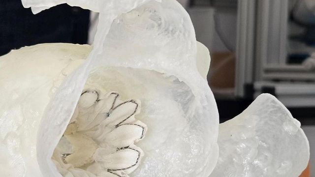 Protesi in simultanea a cuore battente, ingegneri in aiuto dei chirurghi