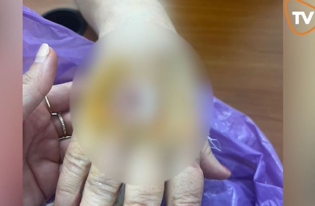 Femeie mușcată de un șacal în parcul de lângă Primăria din Arad, când încerca să-și apere cîinele atacat de animalul sălbatic