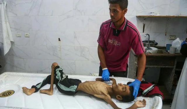 Gaza, el infierno es un saco de huesos