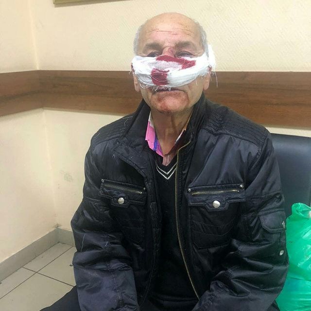 Пенсионер из Петербурга рассказал, как врач избил его в машине скорой помощи