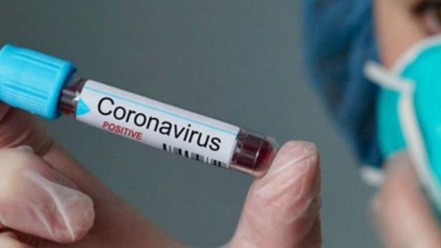 SUA au înregistrat cele mai mai multe cazuri de îmbolnăvire cu noul coronavirus din lume, depășind China