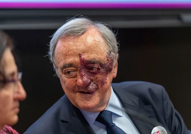 Barbacid logra curar el cáncer de páncreas en ratones