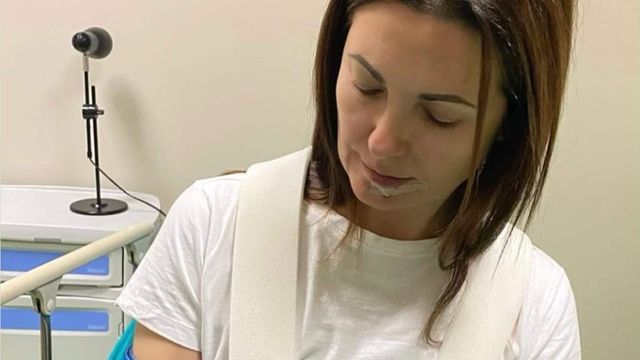 Disavventura per Giovanna Civitillo, la foto dal pronto soccorso: “Poteva andare molto peggio”