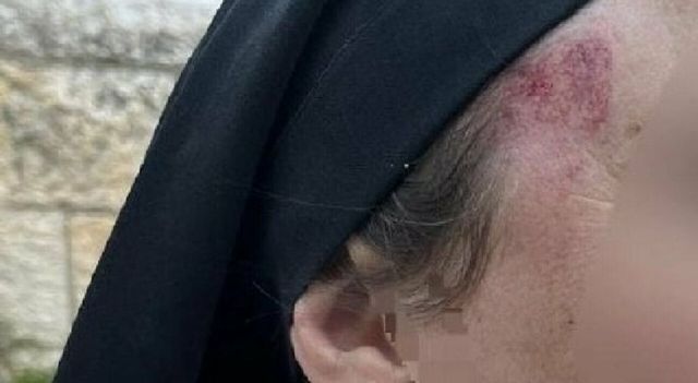 Suora aggredita a Gerusalemme, l'attacco e l'arresto del sospetto