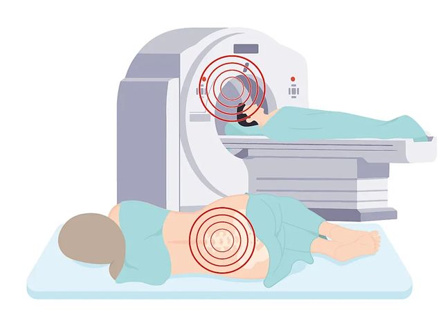 Así son las pruebas para detectar el alzhéimer