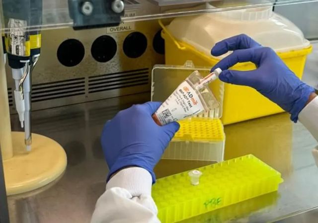 Nace el primer test en sangre que permite adelantarse al desarrollo del alzhéimer