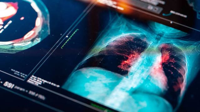 Una IA predice el riesgo de más de mil enfermedades con décadas de antelación