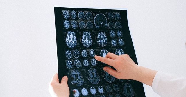 Cele 4 vârste la care creierul nostru se schimbă. Adolescența neuronală durează până la 32 de ani