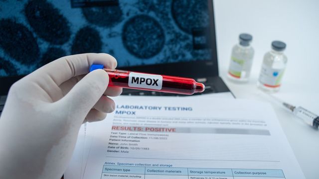 OMS declară epidemia de mpox urgență de sănătate publică de interes internațional. Țările unde este focar de infecție virală