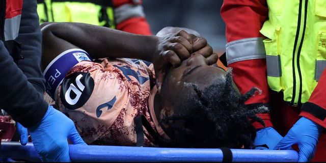 Torino, tripla lesione al ginocchio per Zapata: stagione finita