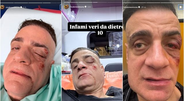 Cicalone aggredito in metro a Roma: come sta lo youtuber